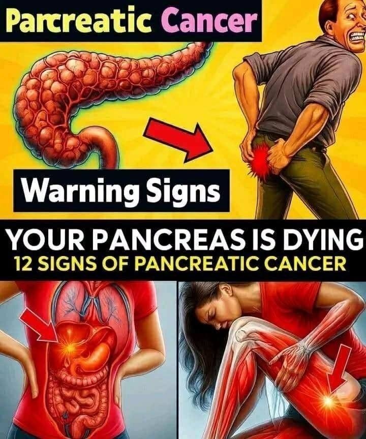 12 Signs of Pancreatic Cancer You Should Never Ignore…. See more