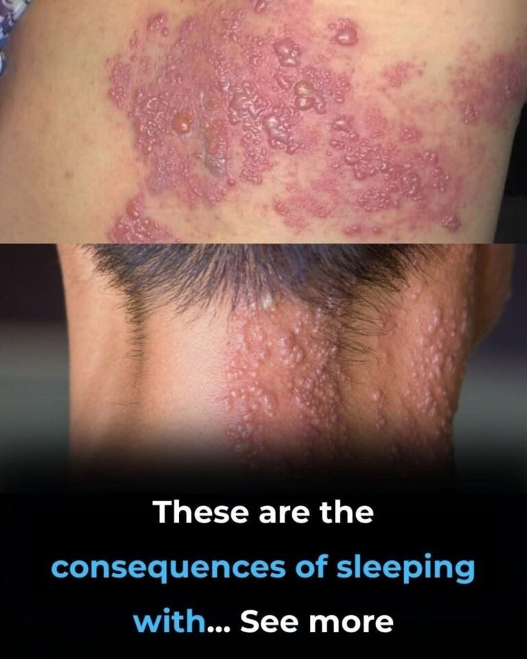 These Are the Consequences of Sleeping With the Wrong Pillow