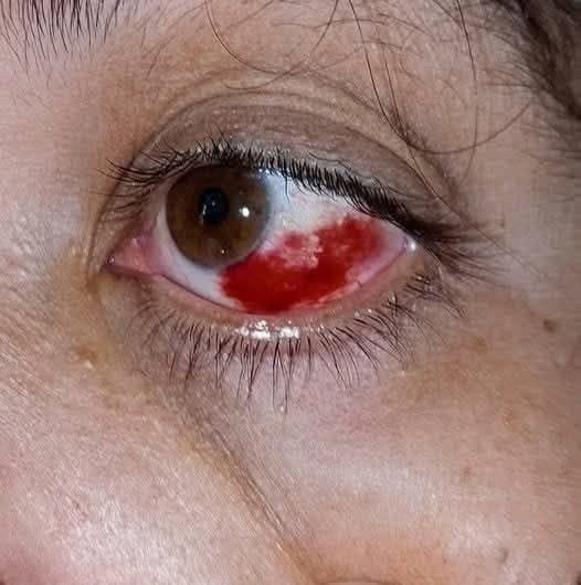 These are the consequences of sleeping with…See more