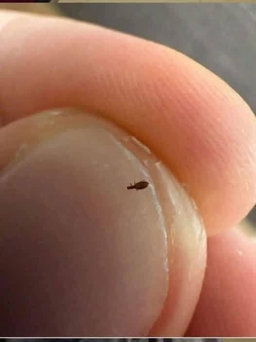 Bug found in my friends hair. What is it?