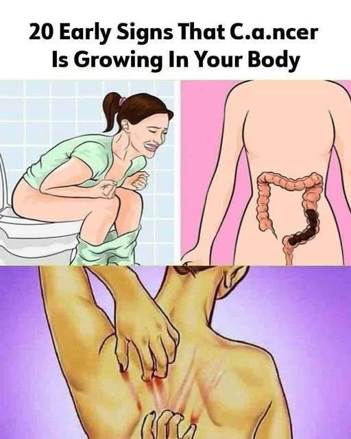 20 Early Signs Your Body is Fighting Cance