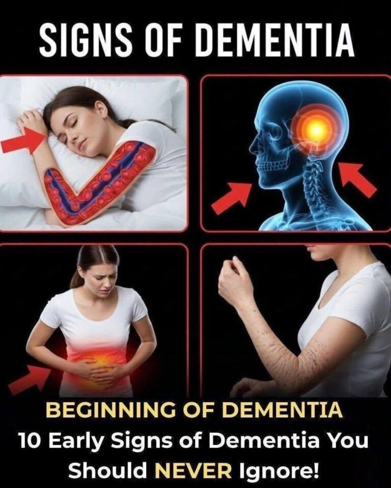 10 Early Signs of Dementia You Should Never Ignore