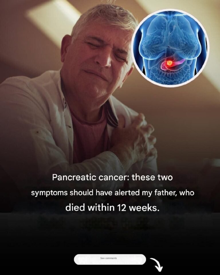 Pancreatic Cancer: Two Early Signs of an Often Fatal Cancer